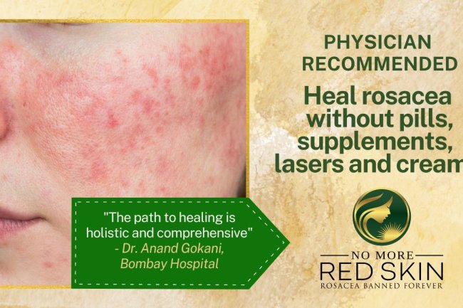 No More Red Skin: Revolutionizing The Rosacea Narrative in India